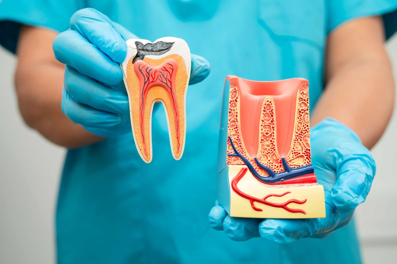 Root canal treatment